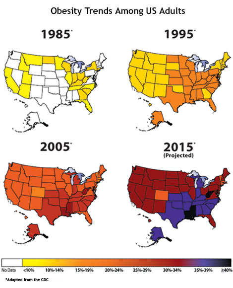 Obesity Trends 2015 - DocMuscles